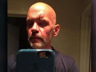 Craig Knapp, 50, tells WFAA he was walking his neighbor's dog early Saturday when two men approached him outside his apartment building. (Photo: WFAA) styles medium public images blog posts Adam Dupuis 2016 05 03 Craig Knapp 1462138422003 2048472 ver1.0 1462183912909 2053121 ver1.0