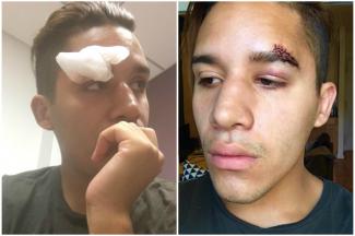 styles medium public images blog posts Adam Dupuis 2016 08 25 hatecrime