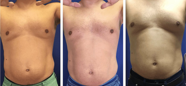 styles large public images blog posts Mike Wood 2017 03 09 All treats Abs