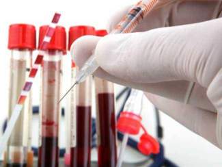 styles medium public images blog posts Adam Dupuis 2017 05 03 58474951