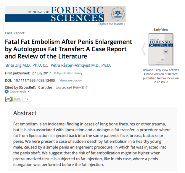 styles large public images blog posts Adam Dupuis 2017 07 30 Screen Shot 2017 07 30 at 3.55.33 PM