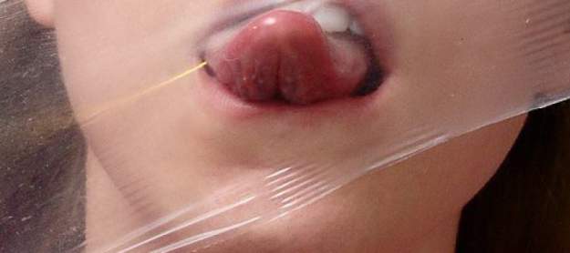 styles large public images blog posts Bryan Keating 2018 01 31 InstinctDentalDam