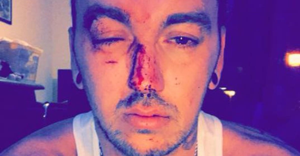 A Gay Couple Were Attacked By Two Unidentified Men For Holding Hands In