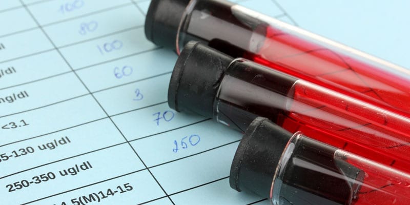 hiv-800.jpg