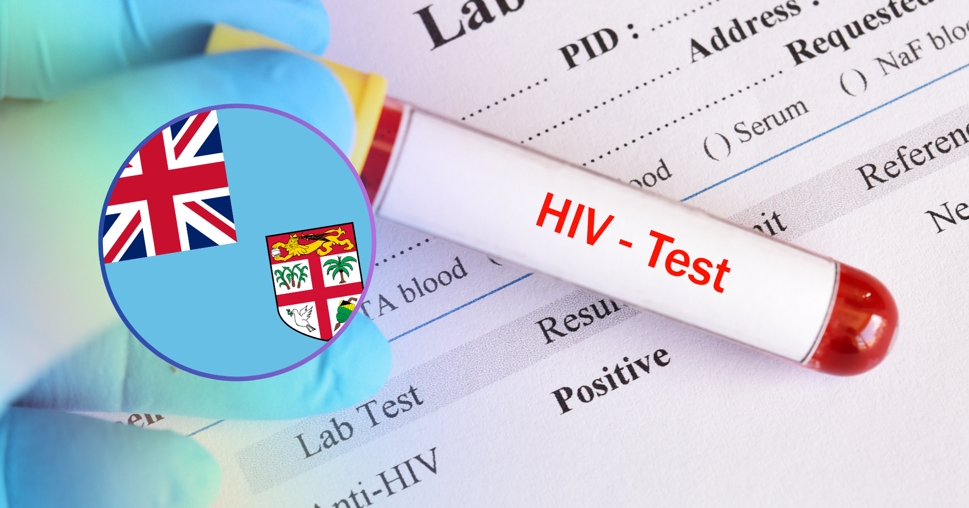 hiv