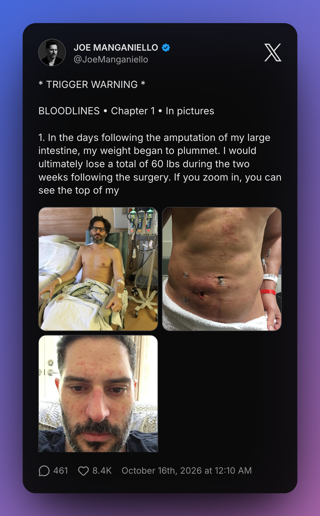 manganiello